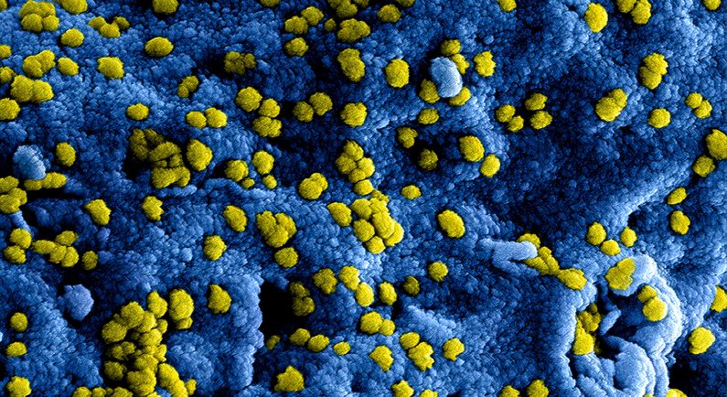 Vijf nieuwe besmettingen coronavirus (update)