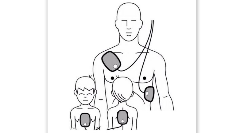 Hoe een AED levens kan redden